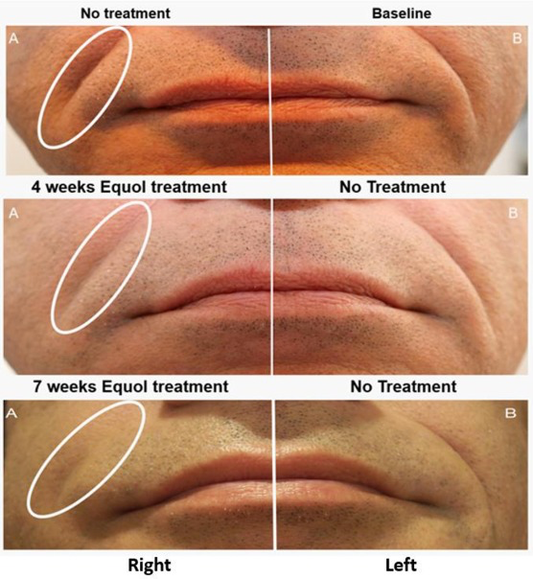 MitoBeauty Equol + Nano CoQ10 + GHK-Cu + Ectoin skin serum